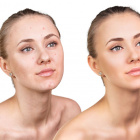 Confidence starts with great looking skin!