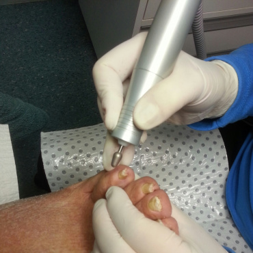General Foot Care