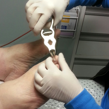 General Foot Care